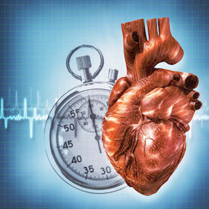 Лечение нарушений сердечного ритма (аритмии)