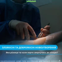Чи варто видаляти дивну родимку або що таке симптом «гидкого каченяти»?