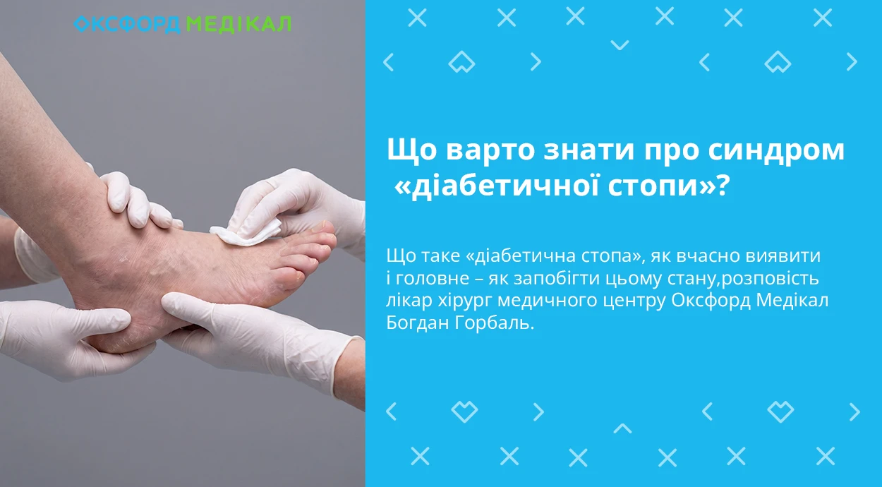Що варто знати про синдром «діабетичної стопи»?