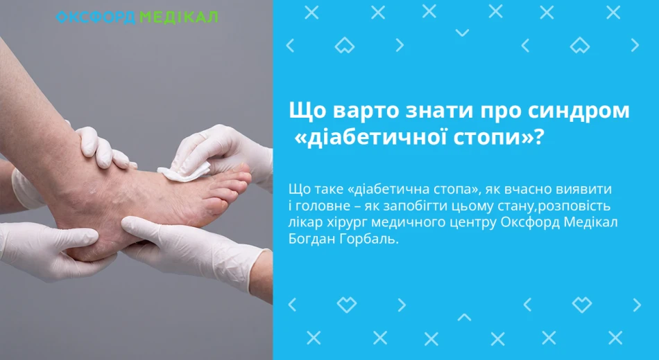 Що варто знати про синдром «діабетичної стопи»?
